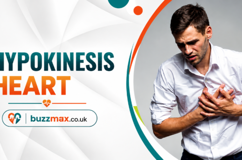 Hypokinesis Heart: What It Means, Causes, Symptoms, Diagnosis, and Treatment